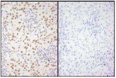 Immunohistochemistry-Paraffin: XRCC1 [p Ser461] Antibody [NB100-533]